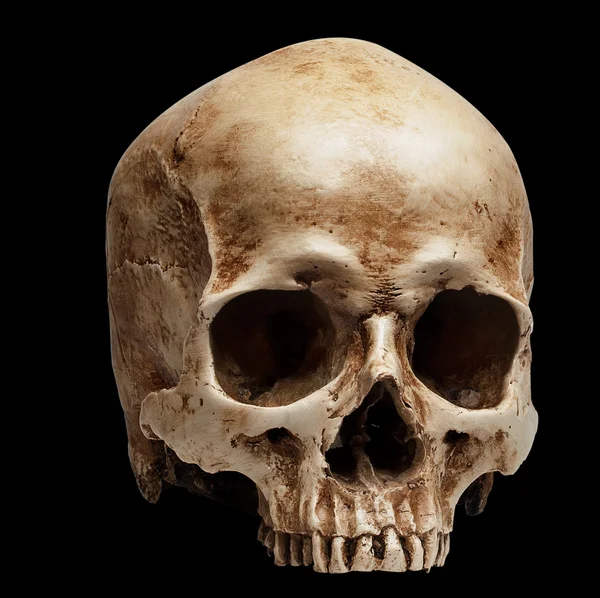 Skull without jaw — Stock Photo, Image