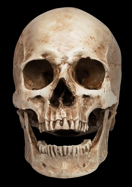 Skull-open mouth — Stock Photo, Image