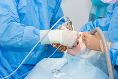 İmplant yerleştirilmesi için ameliyat sırasında diş hekimleri