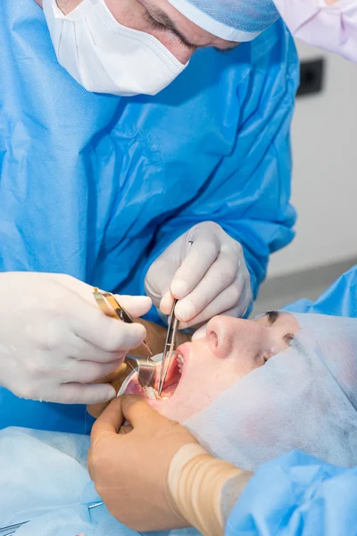 Dentyści podczas operacji implantu — Zdjęcie stockowe