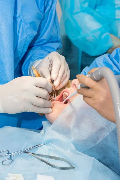 Dentistas durante a cirurgia para colocação de implantes — Fotografia de Stock