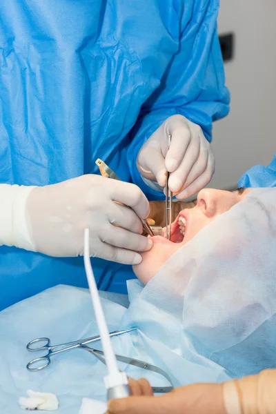 Dentists during surgery for implant placement — Stock Photo, Image