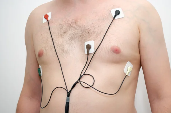 Homem usando holter monitor — Fotografia de Stock