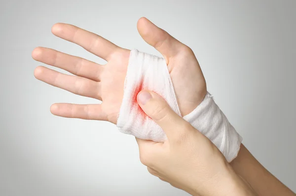 Mão ferida com bandagem sangrenta — Fotografia de Stock
