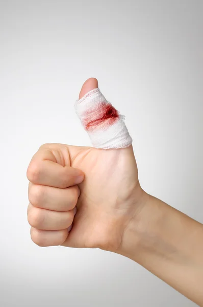 Verletzter Finger mit blutigem Verband — Stockfoto