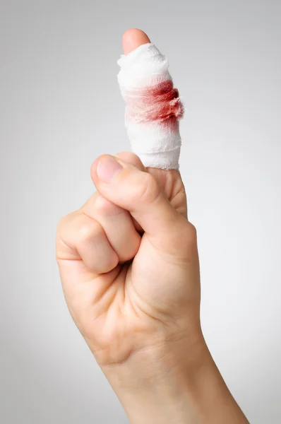 Dedo ferido com bandagem sangrenta — Fotografia de Stock