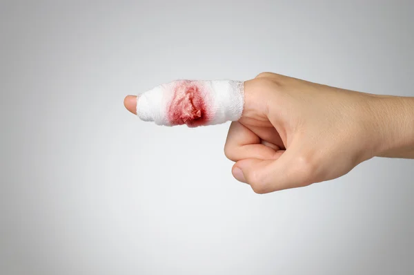 Dedo ferido com bandagem sangrenta — Fotografia de Stock