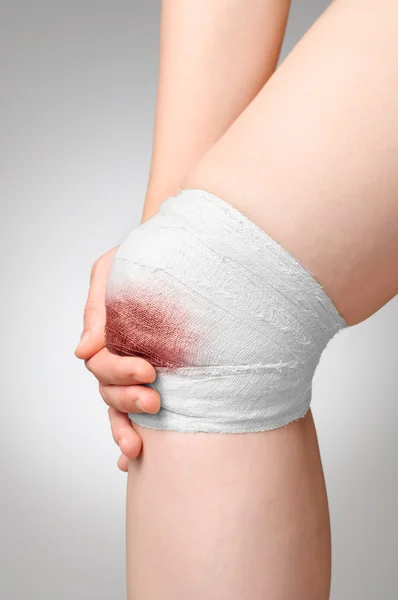 Verletztes Knie mit blutigem Verband — Stockfoto