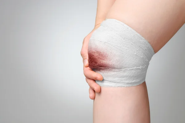 Rannych kolana z krwawej bandaż — Zdjęcie stockowe
