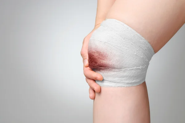 Rodilla lesionada con vendaje ensangrentado — Foto de Stock