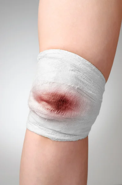 Rodilla lesionada con vendaje ensangrentado — Foto de Stock