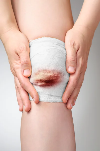 Verletztes Knie mit blutigem Verband — Stockfoto