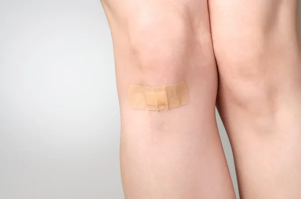 Plâtre sur la jambe féminine — Photo