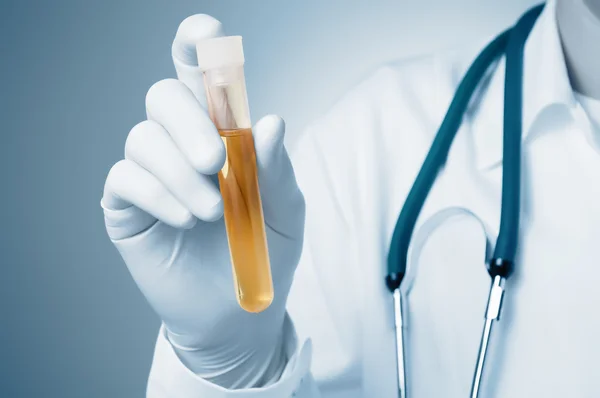 İdrar örneği tutan doktor