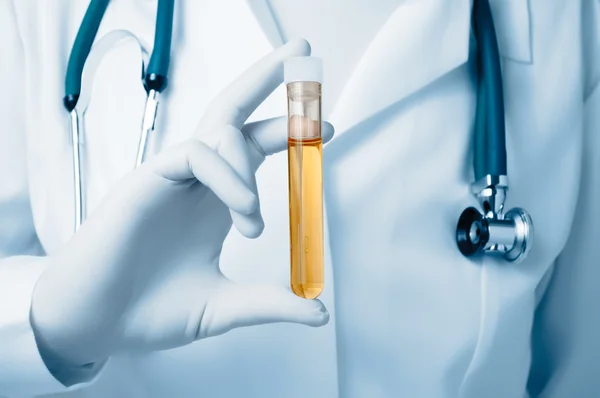 Médico segurando amostra de urina — Fotografia de Stock
