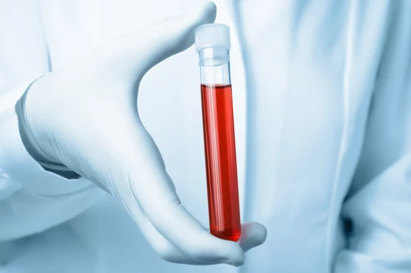 Hand with blood sample — Stock Photo, Image