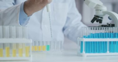 Laboratuvar. Mavi eldiven tüpleri hareket ettirir ve mavi sıvı damlatır. Test tüpünde sarı ve mavi sıvı numunesi tutan bir tıp çalışanı laboratuardaki idrarı analiz ediyor..