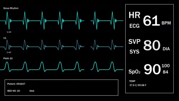 Looped: A beteg monitoron életjelek EKG elektrokardiogram EKG, oxigén telítettség SPO2 és légzés. Orvosi vizsgálat. 4K videofelvétel animáció. Szívmonitorozás. Elektrokardiográfia — Stock videók