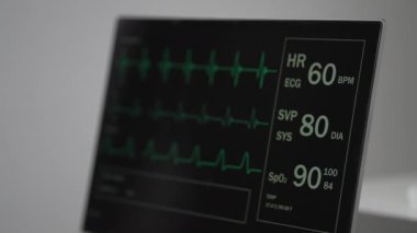Hasta monitöründe ECG elektrokardiyogram EKG, oksijen doygunluğu SPO2 ve solunum belirtileri görülüyor. Tıbbi muayene. 4K video animasyonu. Kalp monitörü. Elektrokardiyograf