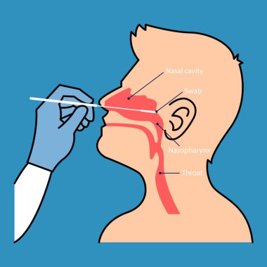 Burun temizleme testi. Covid-19 Coronavirus testi bir tıp personeli, doktor ya da hemşire tarafından gerçekleştirildi. Düz tasarım vektörü.