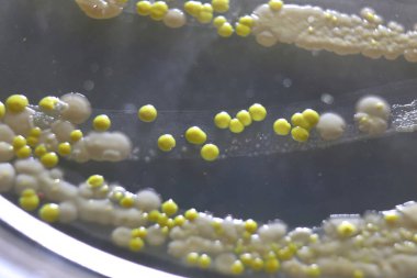 Bakteri ve hamur mayası kolonilerinin makro görüntüsü