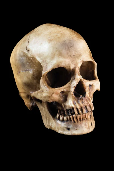 검은 배경의 사람의 두개골 — 스톡 사진