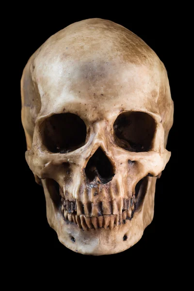 Menschlicher Schädel auf schwarzem Hintergrund — Stockfoto