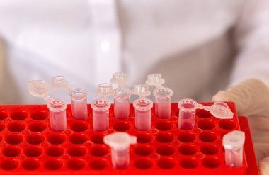 Steril ilaç. Kırmızı bir stantta steril kullan-at test tüpleri. Modern bilim laboratuarı kavramı..