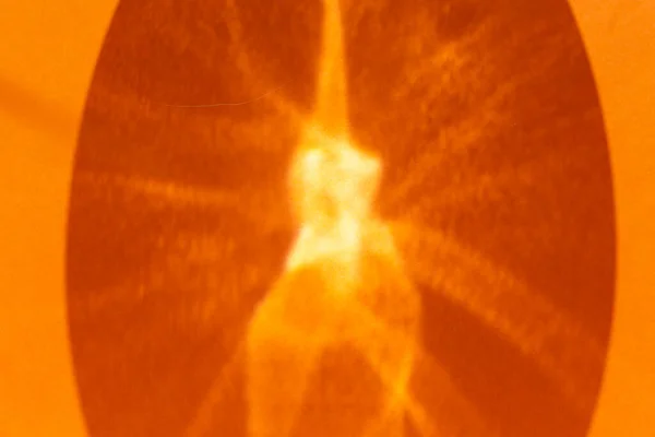 Abstract Oranje Achtergrond Met Schaduwen Glinsteringen Zon Als Flitsen Het — Stockfoto