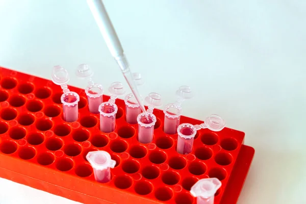 Top view on laboratory table with digital pipette dispenses liquid from a flask into test tubes. Modern medical laboratory concept.