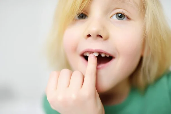 Portrait Boy Shaking Wobbly Milk Tooth Open Mouth Changes Molar — Stock Photo, Image