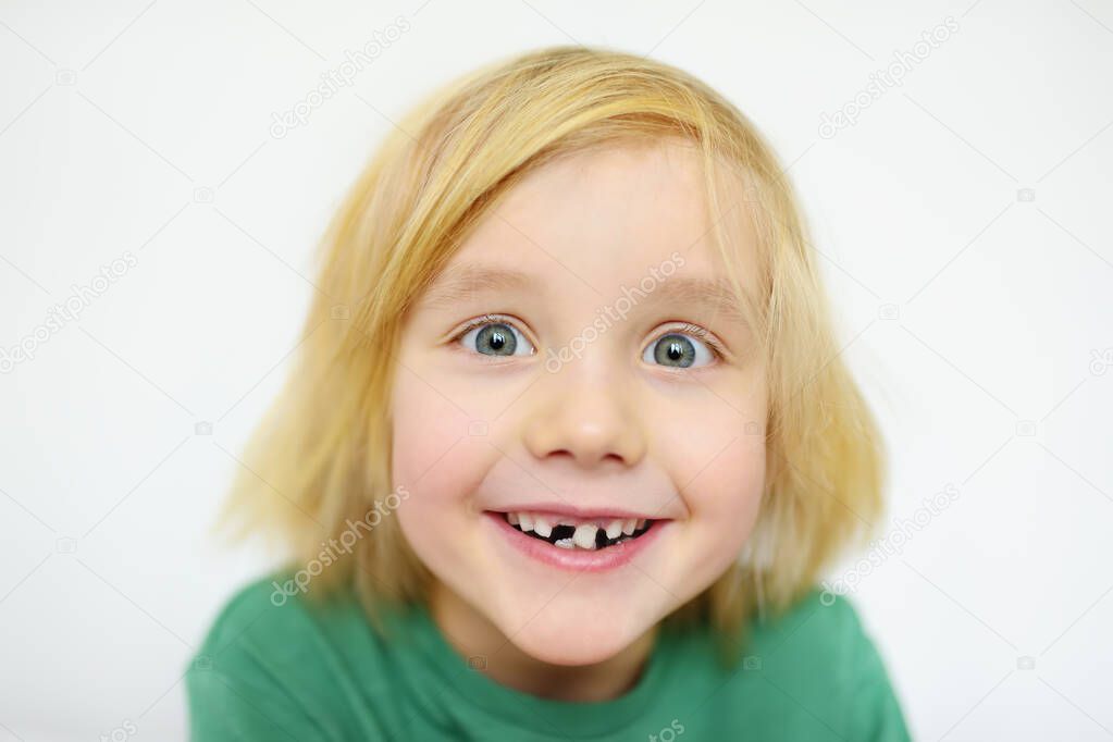 Portrait of boy shaking wobbly milk tooth in open mouth before it changes to the molar. Stages of growing up a child. Health care and dental hygiene for baby. Childhood
