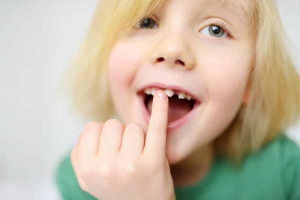 Portrait Boy Shaking Wobbly Milk Tooth Open Mouth Changes Molar — Stock Photo, Image