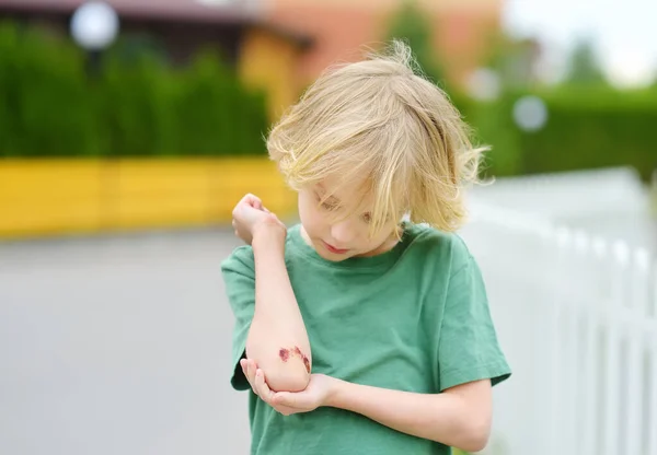 かわいい男の子は傷で肘を見ている 子供の健康と医療の概念 怪我や外傷の後の子供のための応急処置 — ストック写真