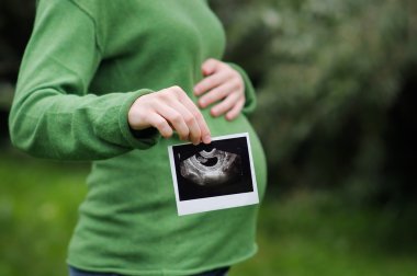 gebelik ultrason taraması 