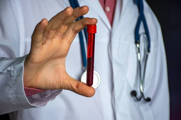 Analizy Kliniczne Probówka Laboratoryjna Krwią Lekarz Lub Naukowiec Trzyma Ręku — Zdjęcie stockowe