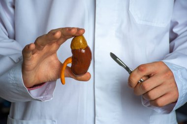 Böbrek ve böbrek ameliyatı tıbbi cerrahi fotoğraf fikri. Doktor bir elinde üreterli bir böbrek modeli, diğer elinde ise bir neşter tutuyor. Bir cerrahi müdahalenin ameliyat edilip alındığını gösteriyor. 