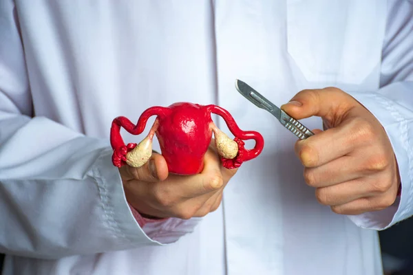 Gynecological Surgery Women Concept Photo Gynecologist Surgeon Holds Model Uterus — Stock Photo, Image