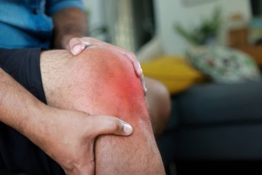 Kırmızı iltihaplı ve moraran yaralı dizini tutarken yakın plan. Tıbbi konsept eklem ağrısı, eklem iltihabı, kemik hasarı, kas ağrısı ya da açık hava güneş ışığı arka planında burkulma..