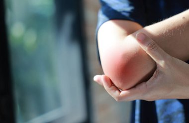 Acı veren dirseğine kırmızı renklerle masaj yapan bir kadın. Tenis dirseği, kemik iltihabı, eklem iltihabı ve sağlık hizmetleri, fizik tedavi ve tıbbi tedavi için kas gerginliği konsepti.