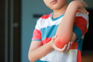 Asyalı çocuk dirseği iltihaplı, elinde eklem ağrısı ya da kas zedelenmesi var. Pediatrik sağlık hizmeti kavramı, çocukların kemik sorunları, kol ağrısı ve ortopedik tıbbi tedavi.