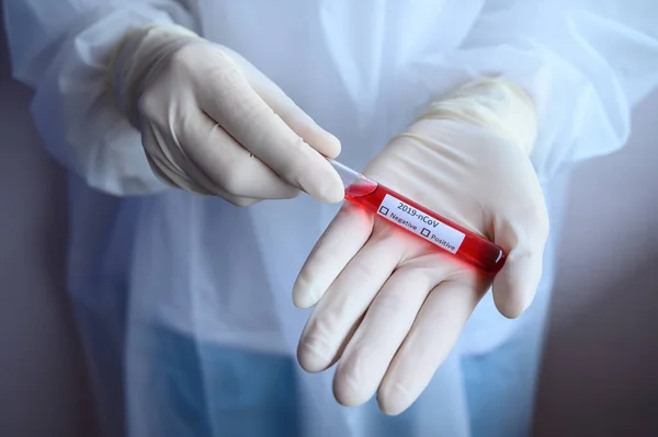 科学家手拿着血样试管进行2019 Ncov分析 2019年呼吸道大肠癌 Covid 实验室检测的概念 — 图库照片