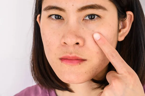 Pendekatan Dengan Wanita Yang Menunjukkan Masalah Pada Wajahnya Dengan Berbagai — Stok Foto