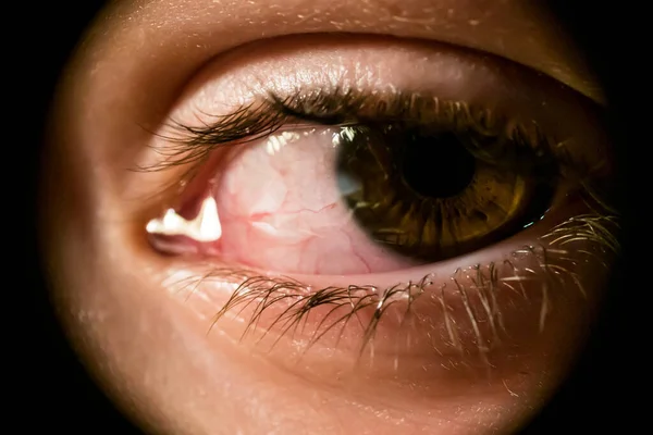 Close Little Boy Tear Stained Eye — Stock Photo, Image