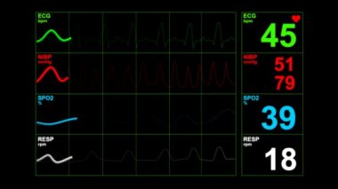 Hastane tiyatrosunda kalp atış hızı monitörü. Anestezi cerrahi monitörüne bağlı bir hastanede tıbbi hayati göstergeler monitörü. EKG. Hasta kalp atışı ekranda.