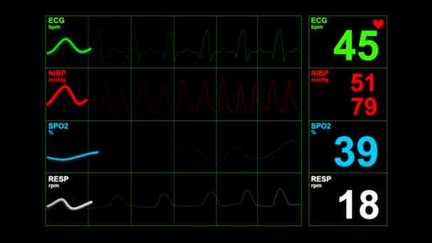 医院手术室的心率监测器 医院麻醉手术监测中的医用生命体征监测仪器 心电图 银幕上的病人心跳 — 图库视频影像