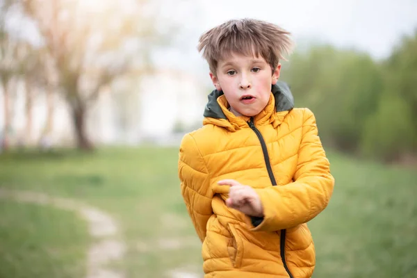 Un bambino in giacca gialla corre sullo sfondo del verde. — Foto Stock