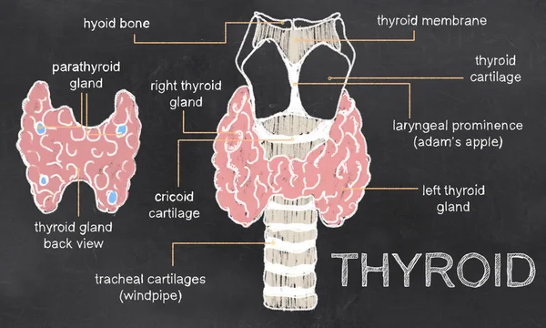 Problèmes de thyroïde sur le tableau noir — Photo