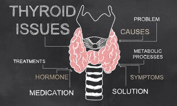 Problèmes de thyroïde sur le tableau noir — Photo