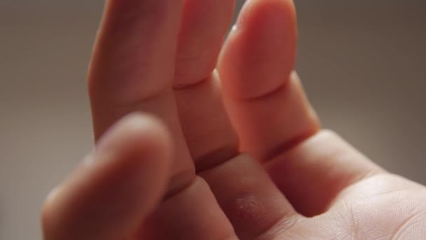 La Dermatología Wart — Vídeo de stock